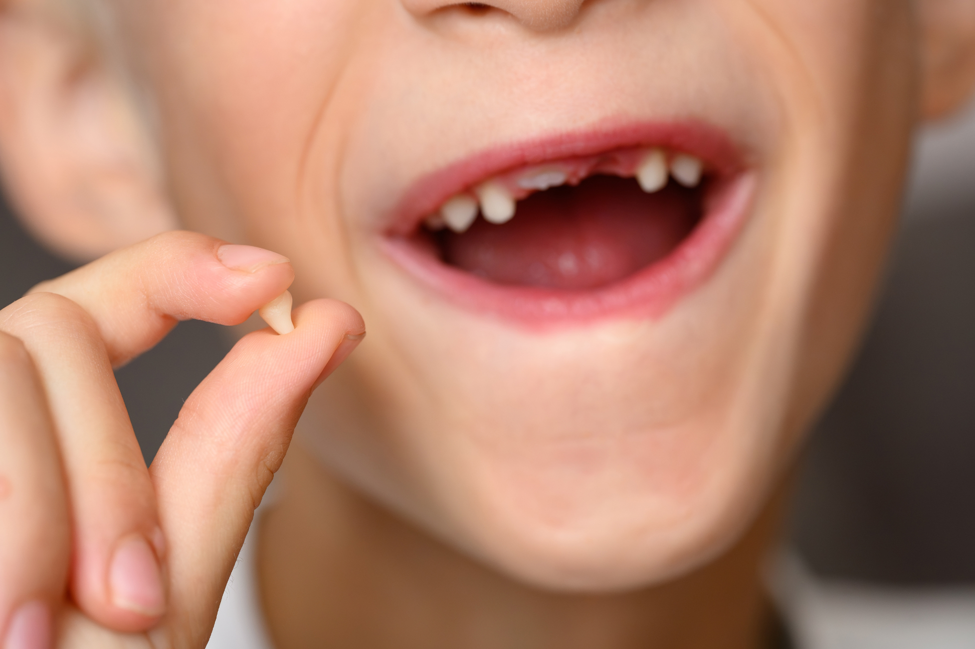child misisng tooth